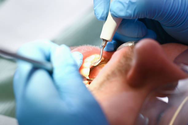Best Urgent Dental Care for Toothache in Warrensburg, IL